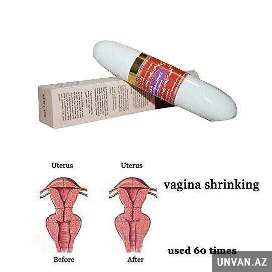 Vagina daraldici şam